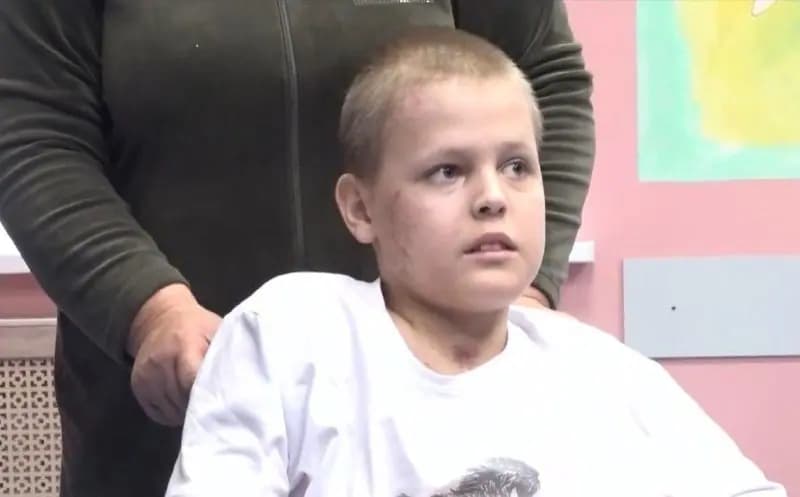11-летний мальчик получил 19 переломов, спасая котёнка от КамАЗа