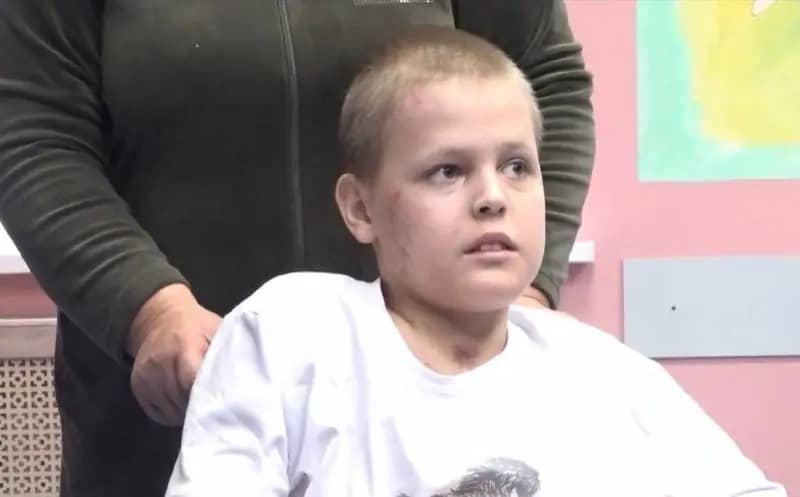 11-летний мальчик получил 19 переломов, спасая котёнка от КамАЗа